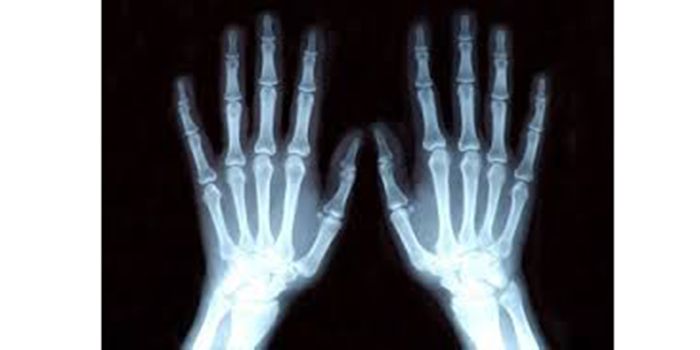 Les mineurs isolés sont de plus en plus considérés comme des migrants au lieu d’être protégés en tant qu’enfants