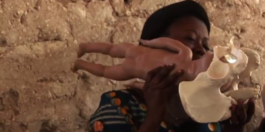 La fistule obstétricale, une plaie de l’humanité précaire